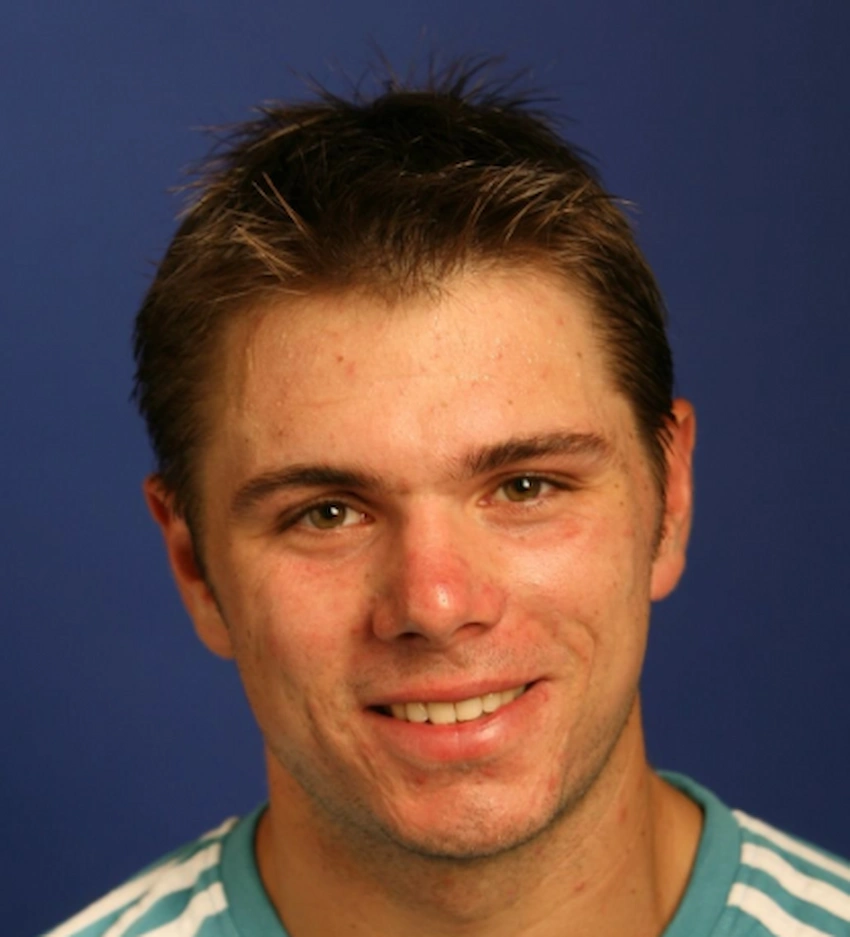 stan wawrinka teeth 2007