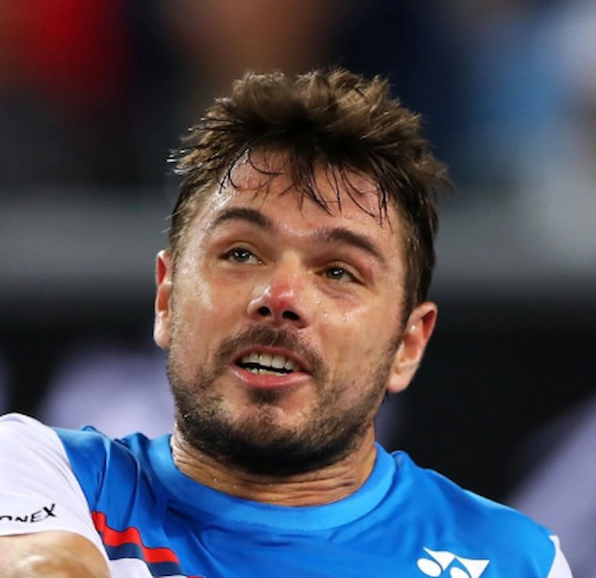 stan wawrinka teeth 2020