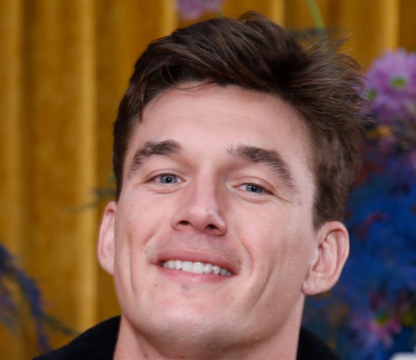 tyler cameron teeth 2020 tyler cameron teeth 2020