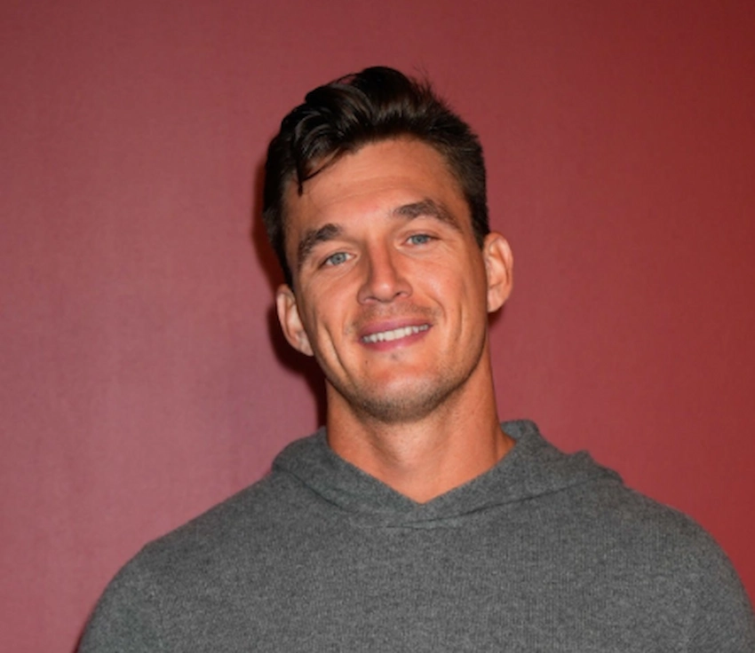 tyler cameron teeth 2022 tyler cameron teeth 2022