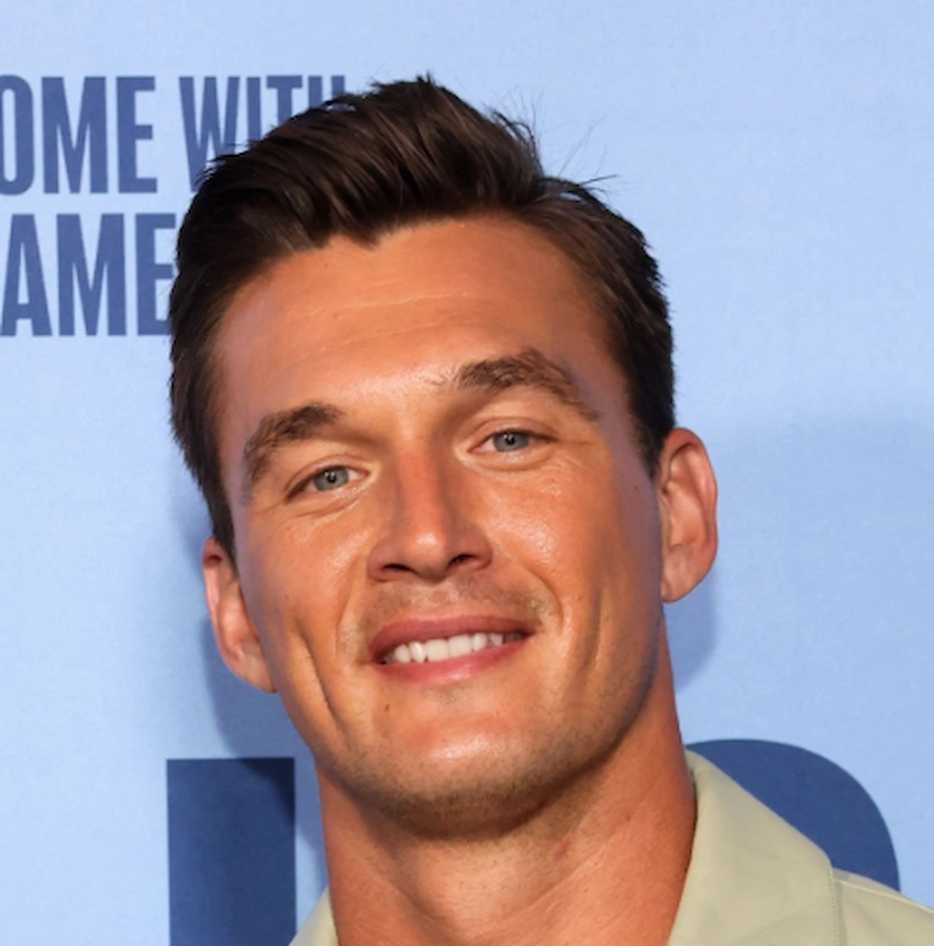 tyler cameron teeth 2024 tyler cameron teeth 2024