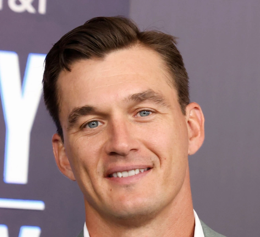 tyler cameron teeth 2026 tyler cameron teeth 2026