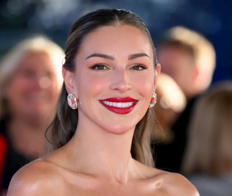 zara mcdermott teeth in 2024