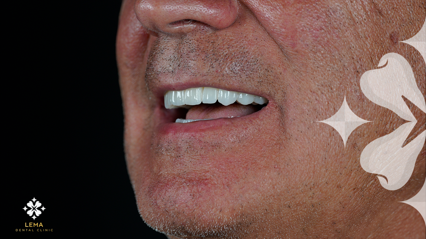5 ways to get rid of coffee stained teeth