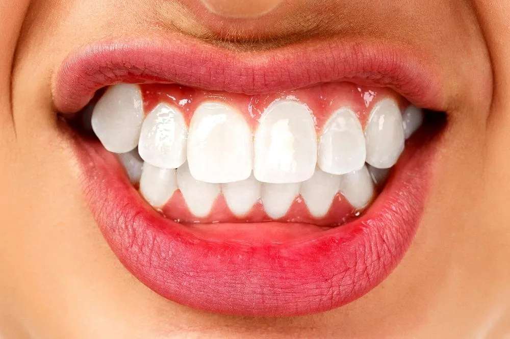 Bruxism