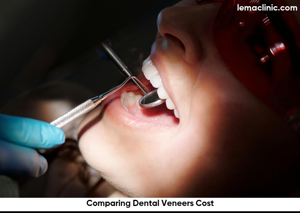 Comparing-Dental-Veneers-Cost6