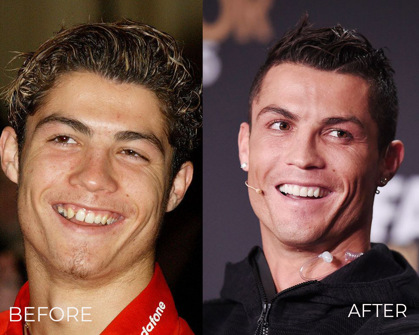 Cristiano Ronaldo преди и след