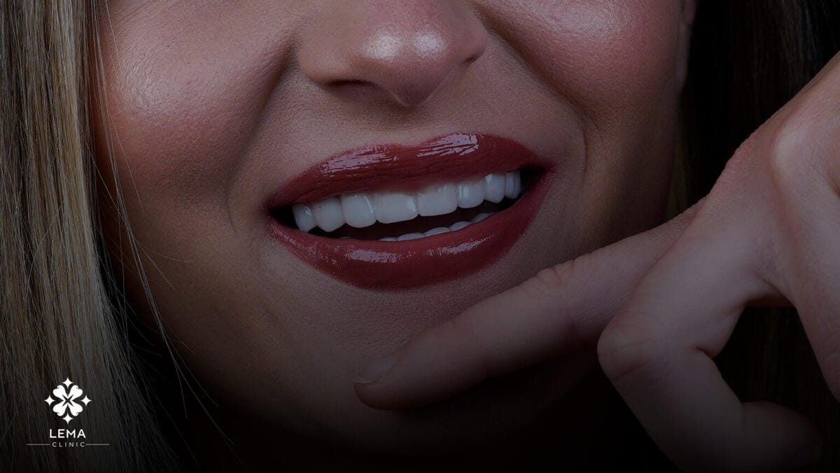 Crowns vs. Veneers Understanding the Difference