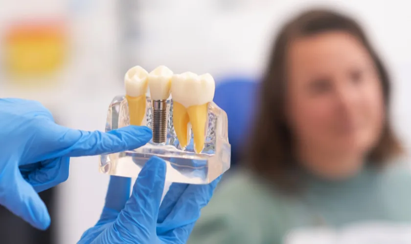d6245-dental-code-keramiska-pontika-uz-implantiem