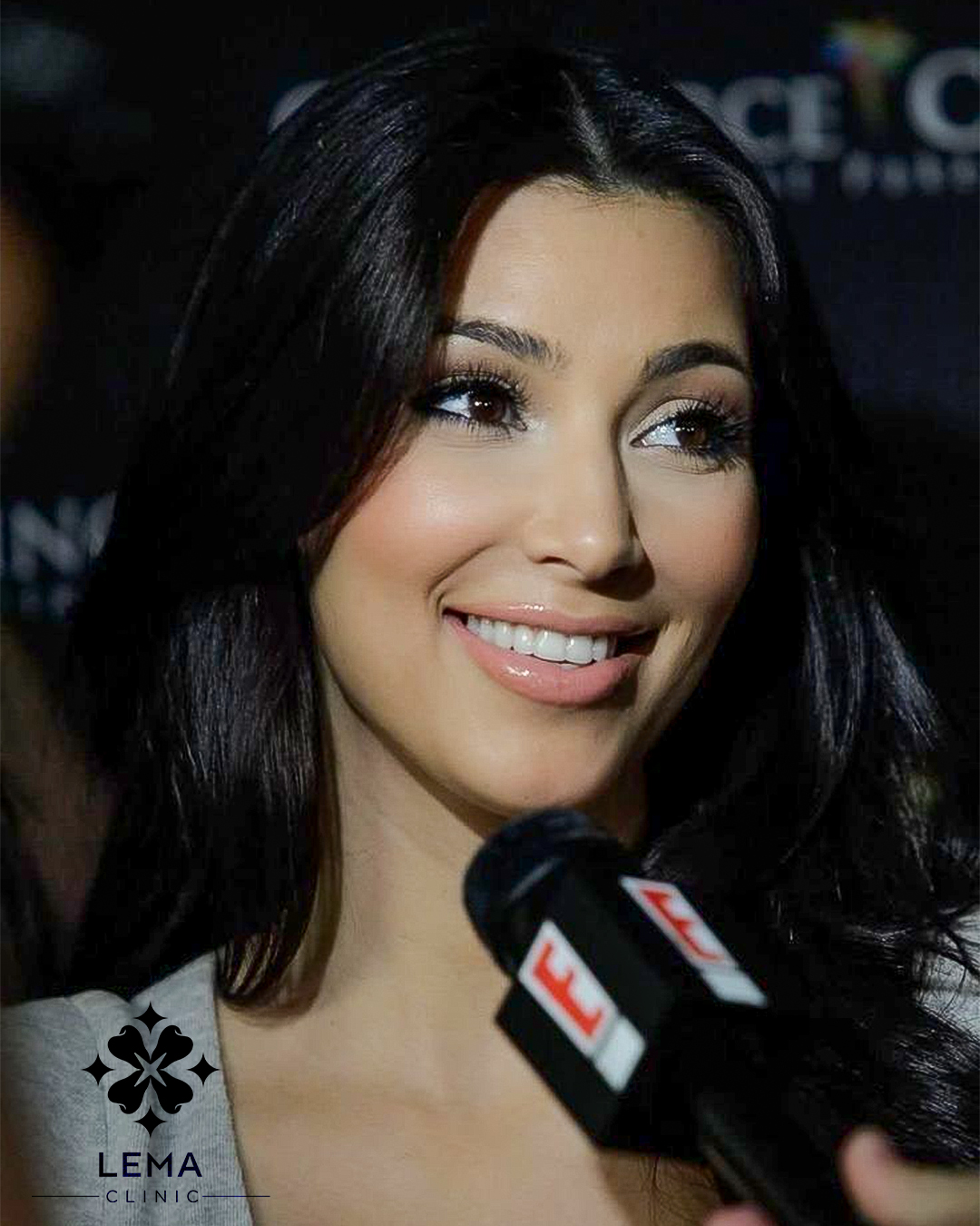 Kim Kardashian Zähne