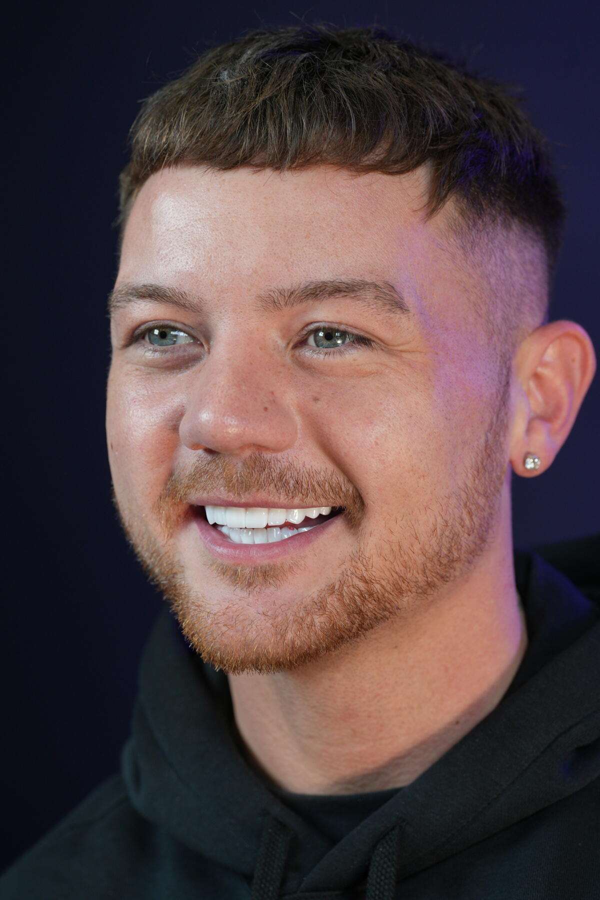 7 Benefits of Zirconium Crowns Lema Dental Clinic 2024