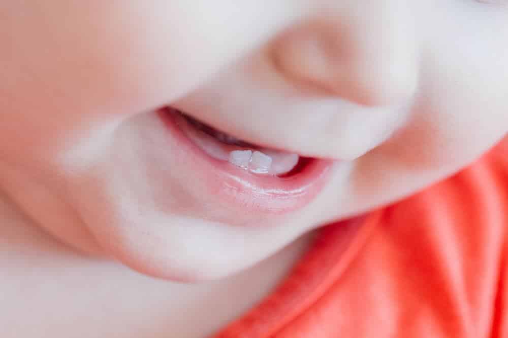 Impact Of Soothers On Baby Teeth