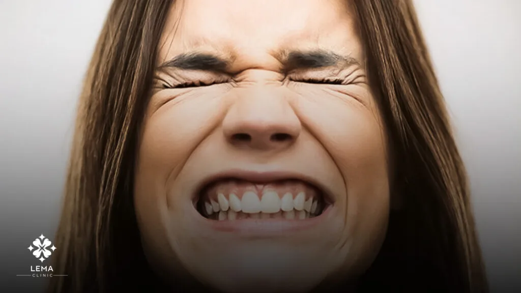 come smettere di digrignare i denti di notte
