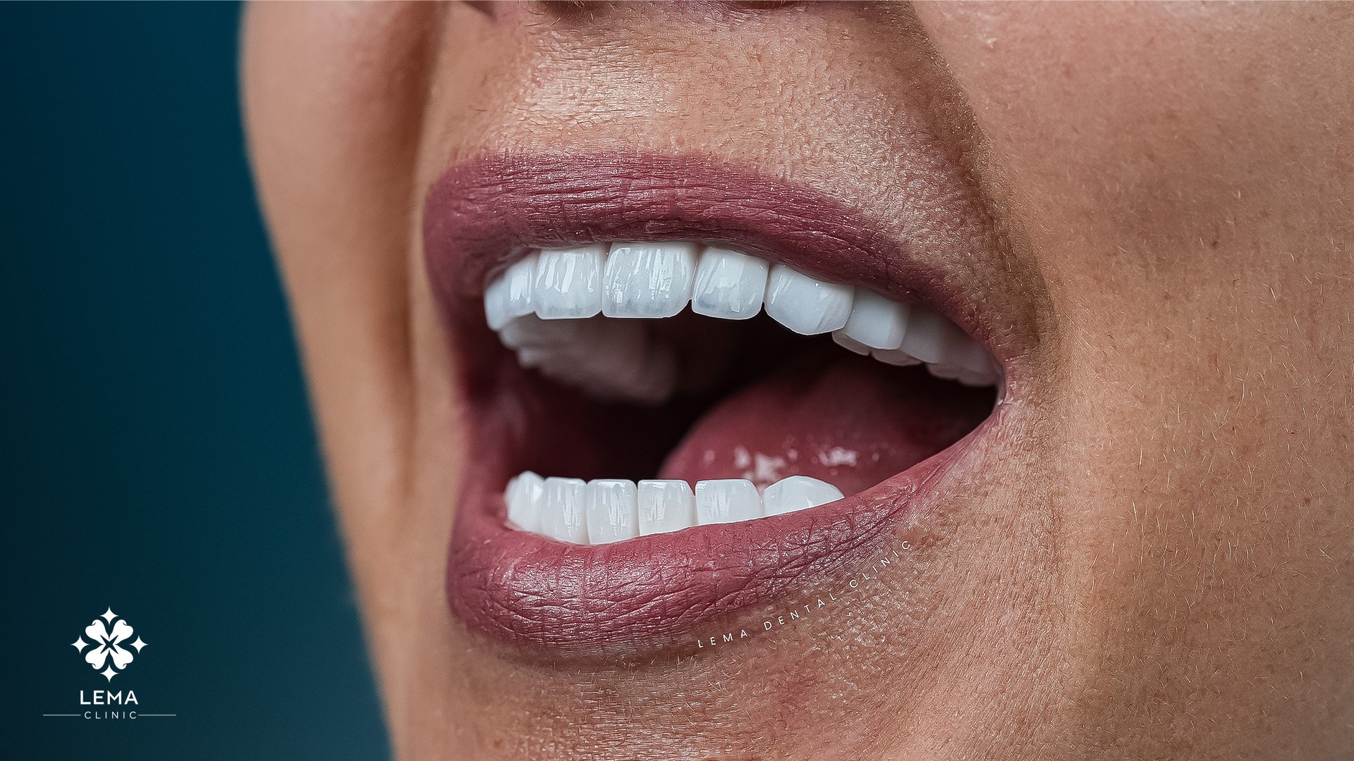 cauze etape si prevenire a bolile gingiilor