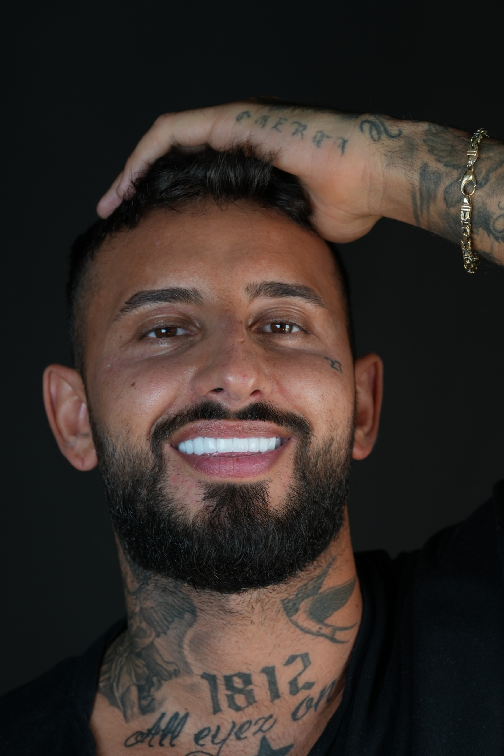 Cosa sono le faccette dentali?