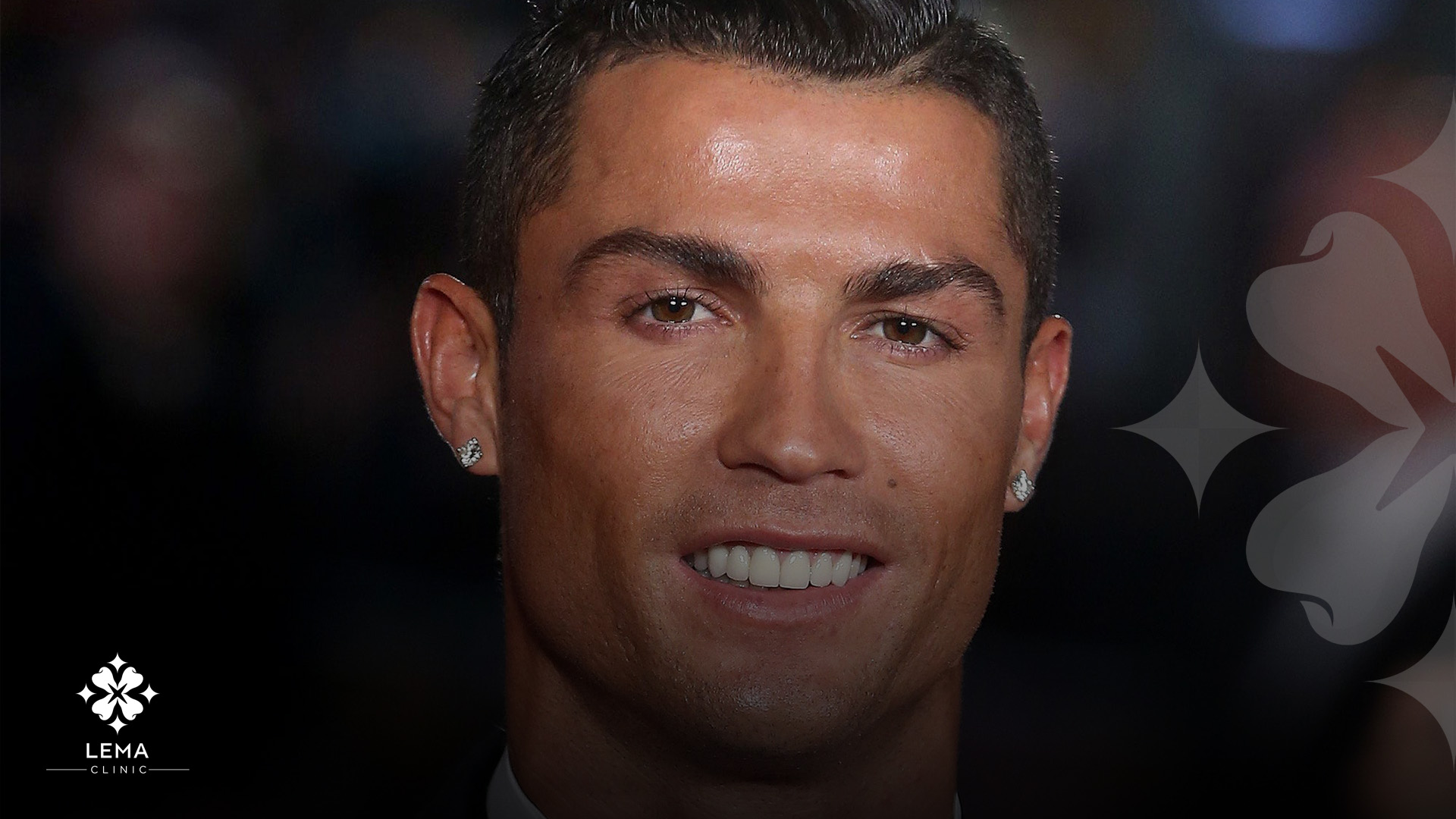 Cristiano Ronaldo's smile makeover