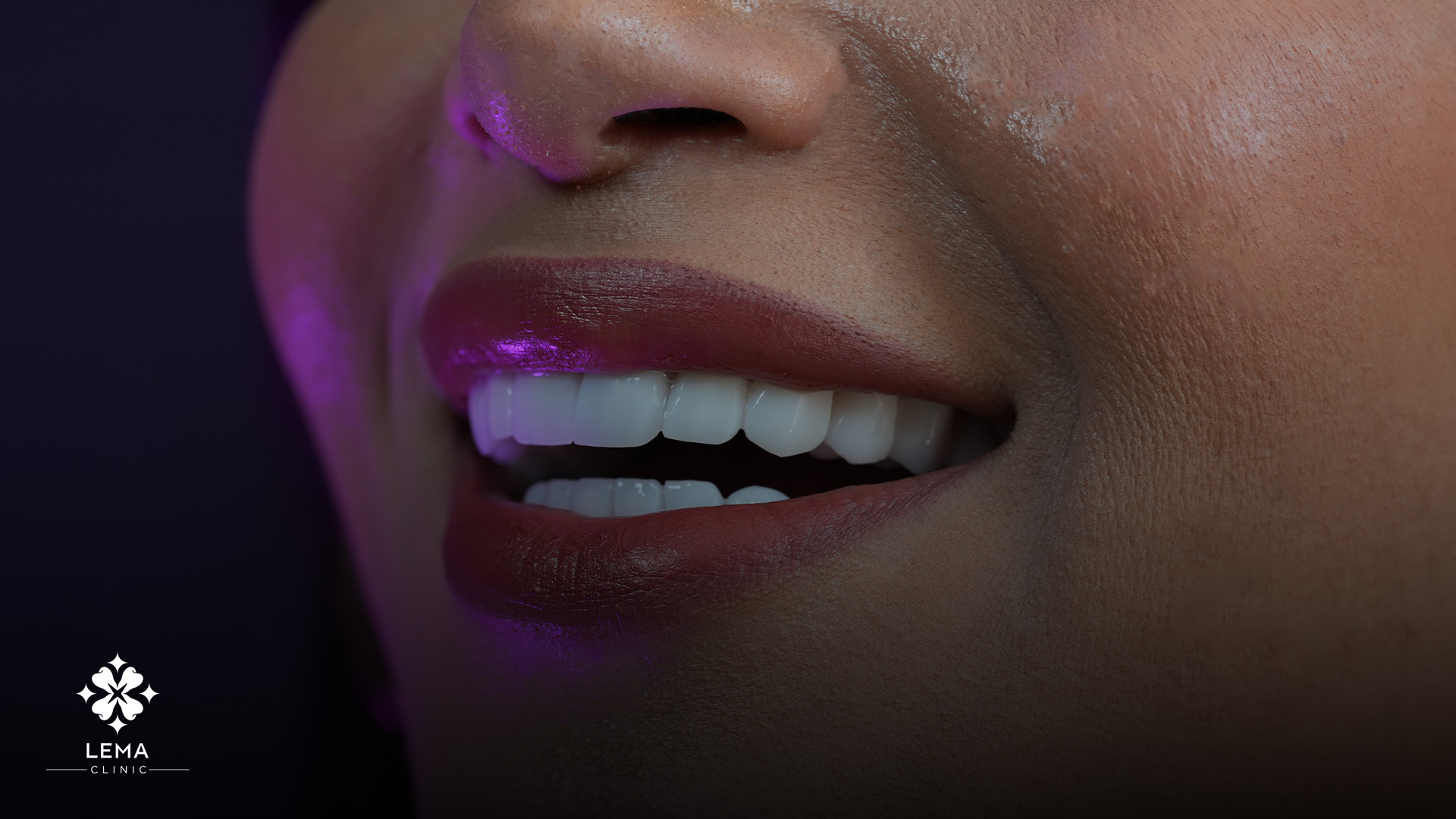 Delai de Revetement en Zirconium