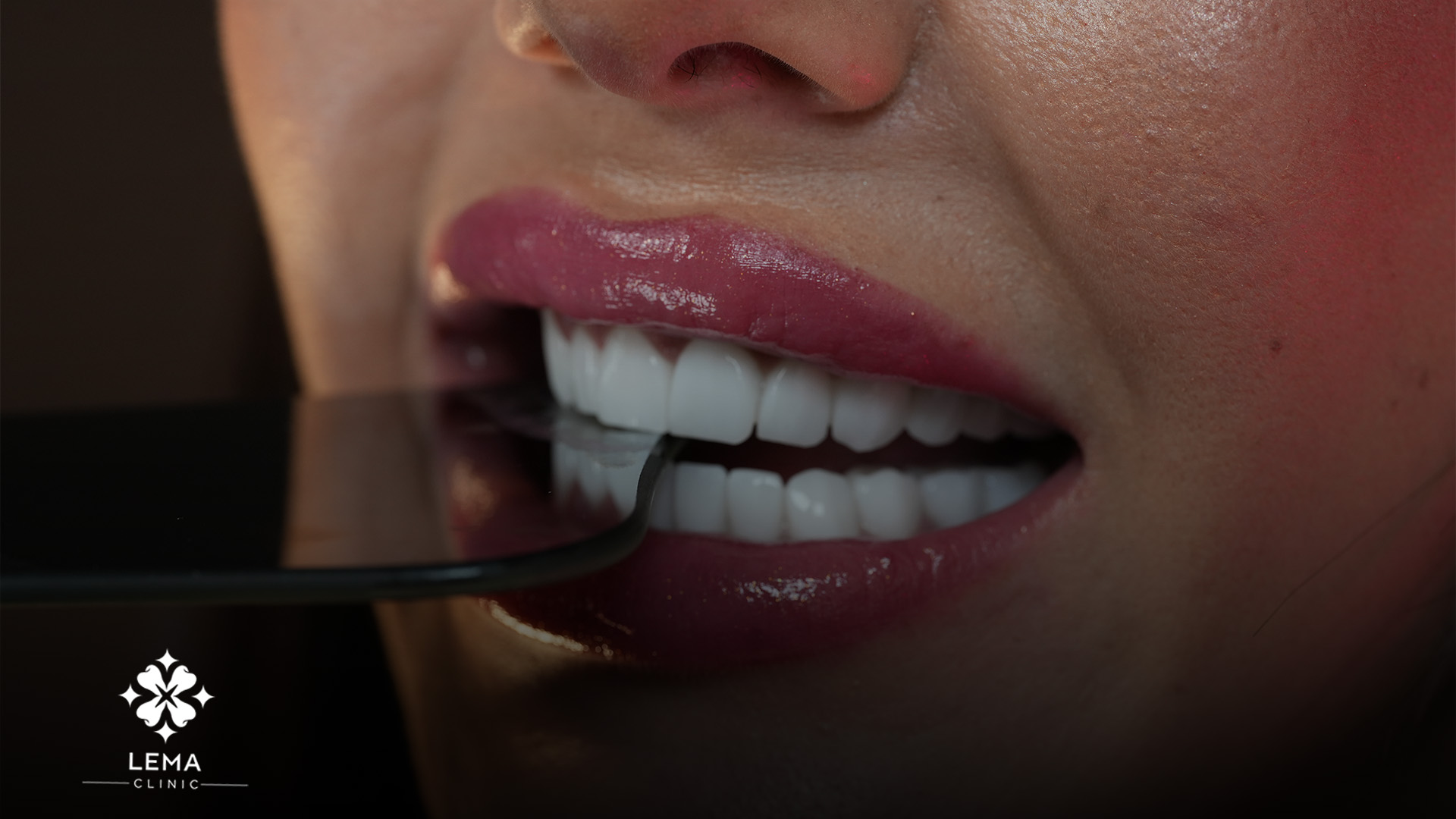 dental implants for all teeth