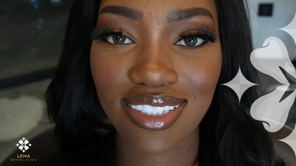 Dents naturelles avec sourire Hollywood