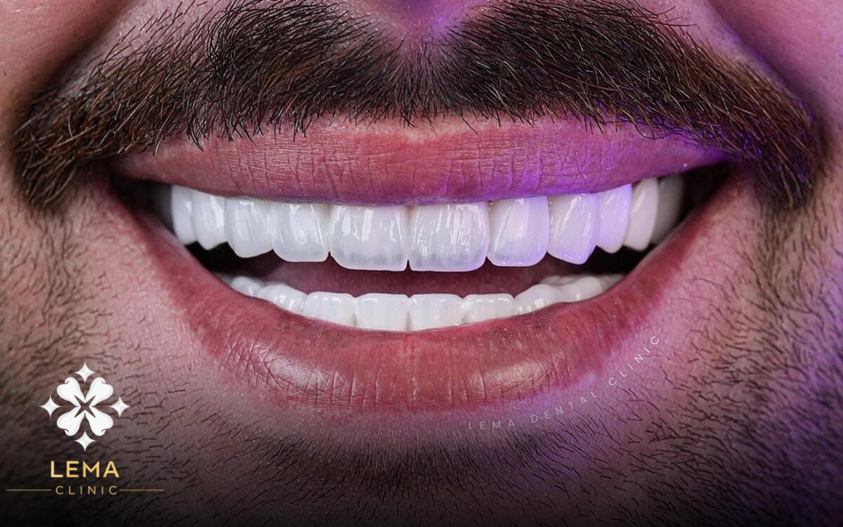 7 Benefits of Zirconium Crowns Lema Dental Clinic 2024