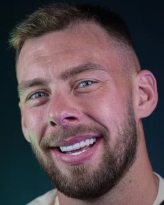 cristiano-ronaldo-teeth hollywood-smile-6.webp