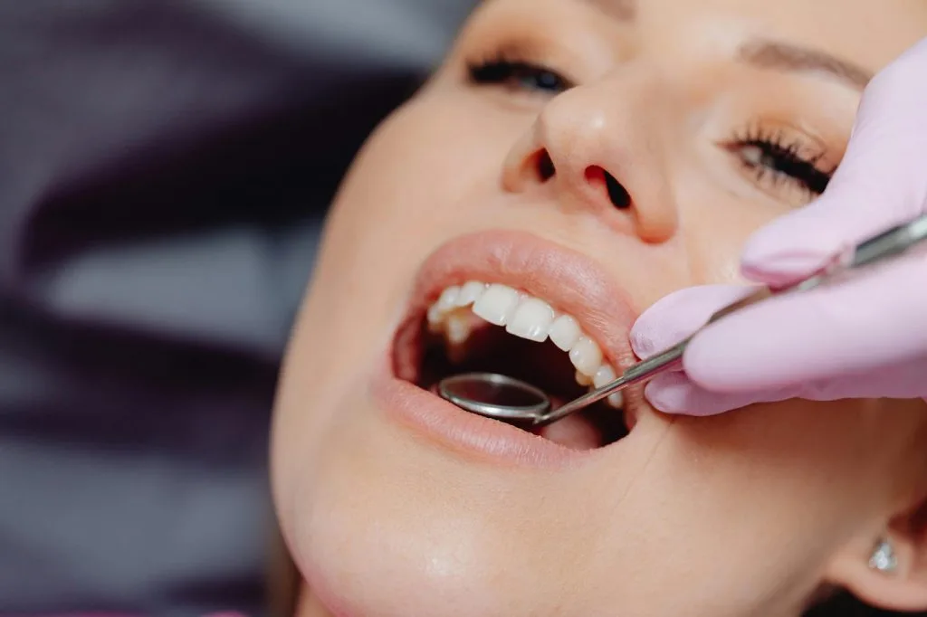sensazione di solletico nei denti