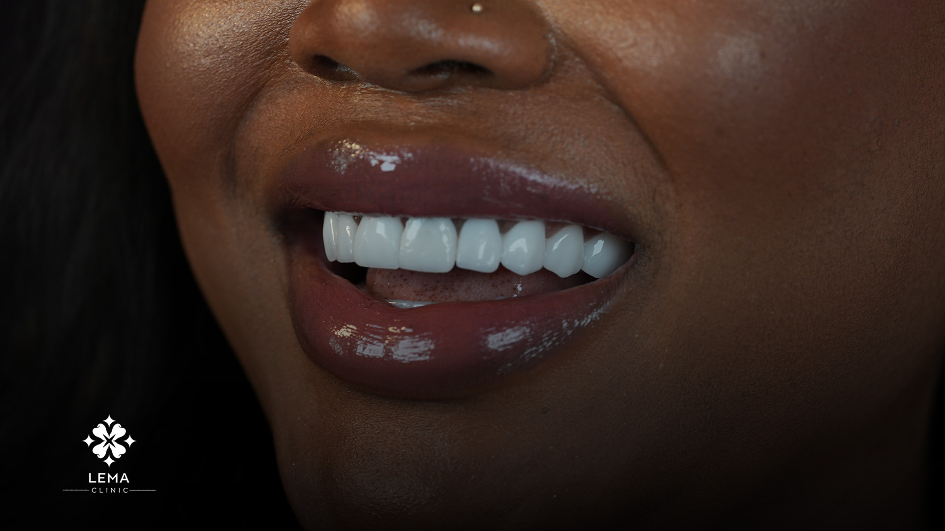 implant dentar
