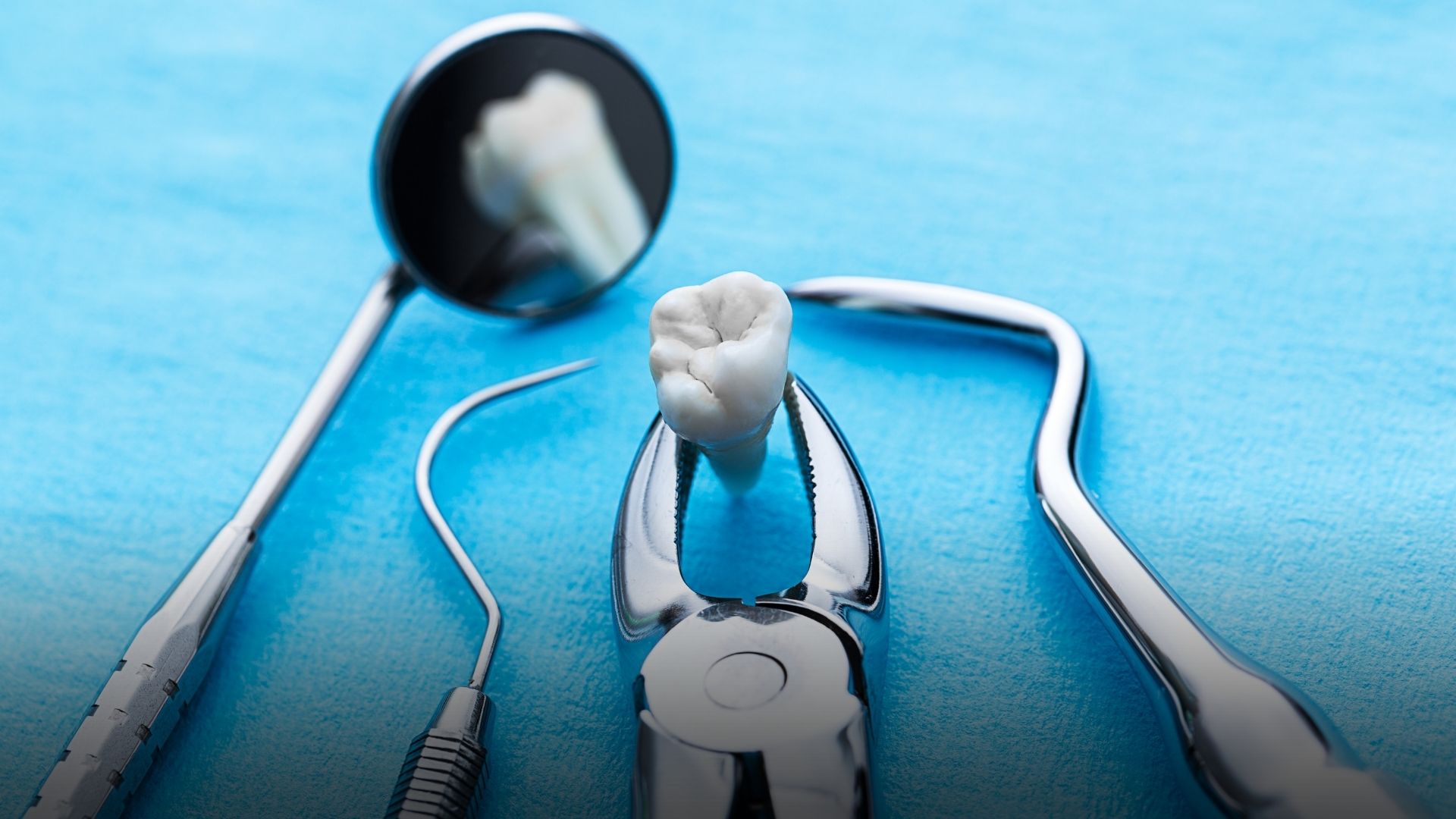 extractie dentara cu infectie