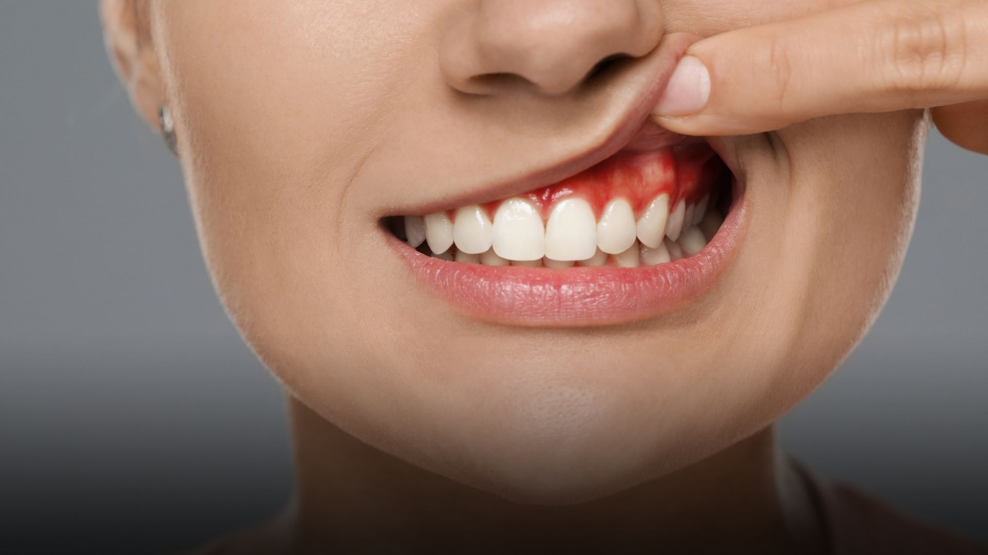 dureri gingivale