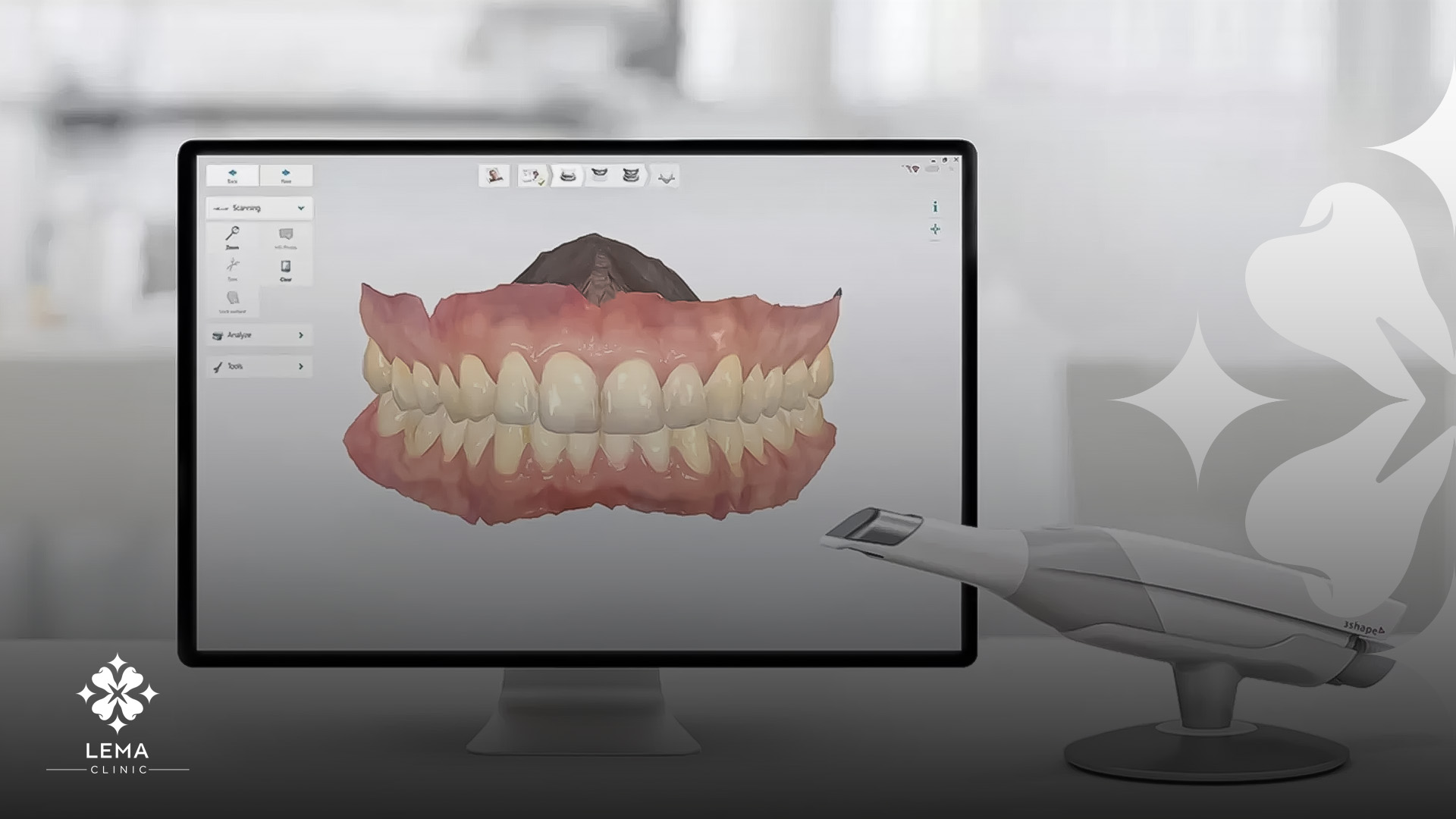 puterea %100 digital smile design