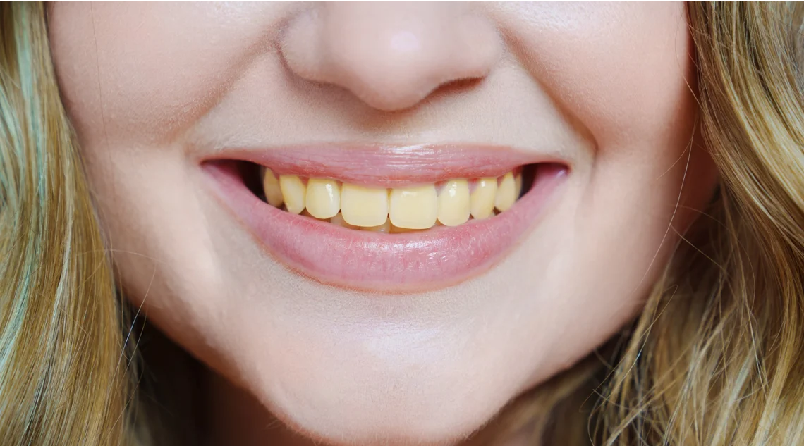 effet du café sur les dents