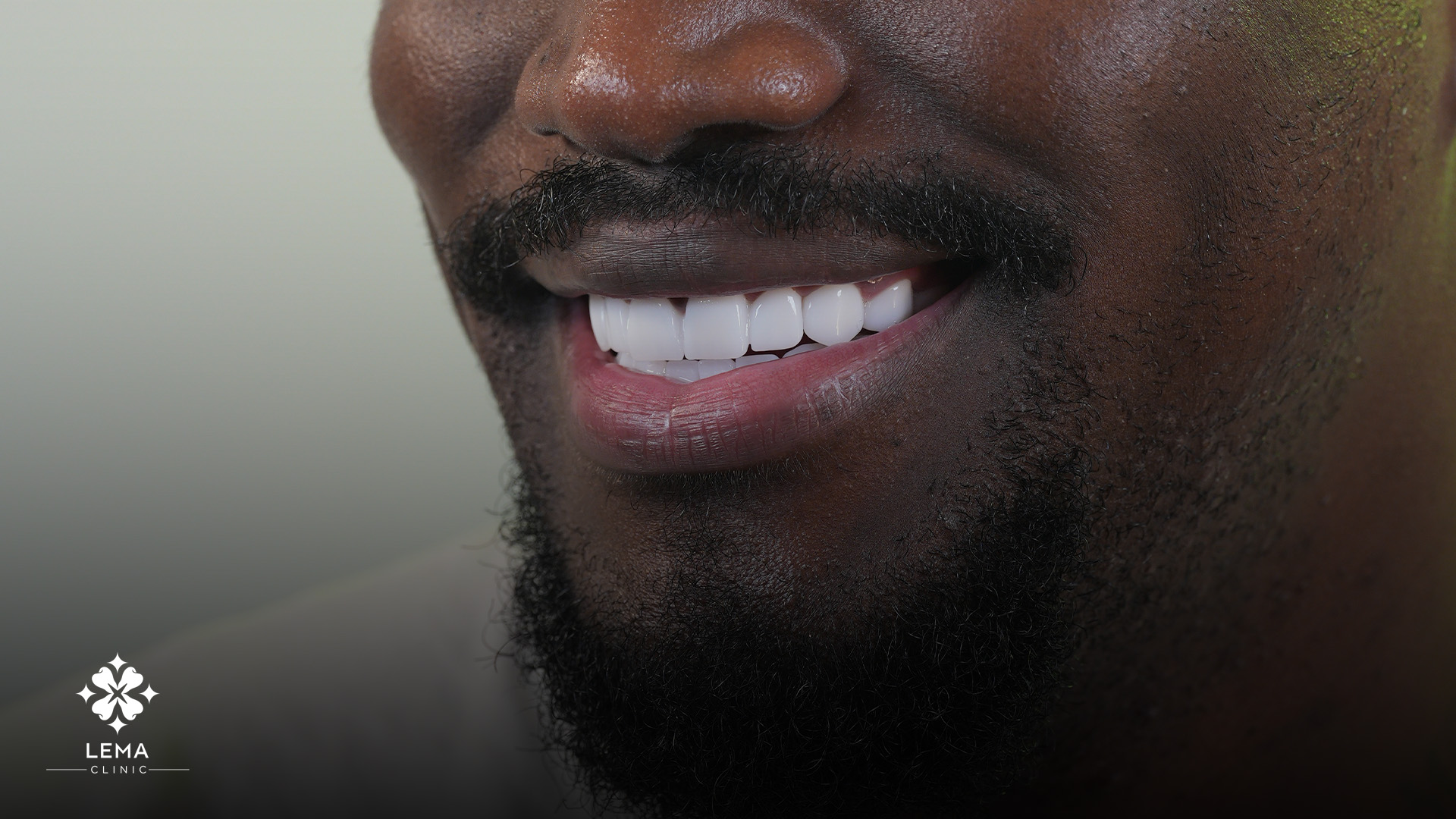 tartaro dentale e suoi effetti