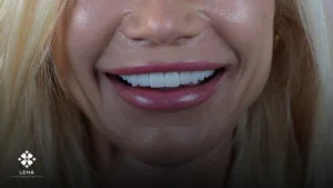 tooth extraction process and aftercare
