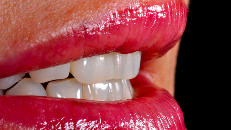 Everything You Need To Know About Turkey Teeth