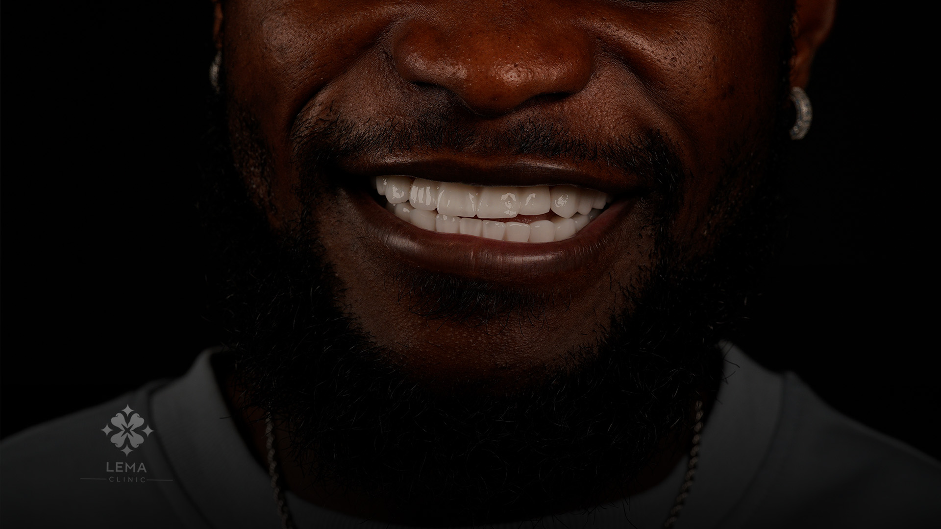 sonrisa perfecta