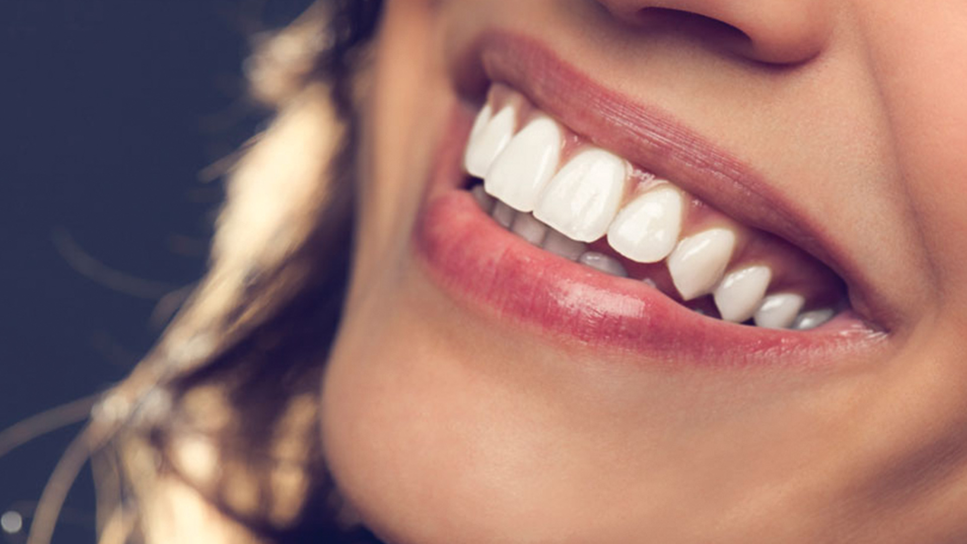 hollywood-smile-turkey-Cost