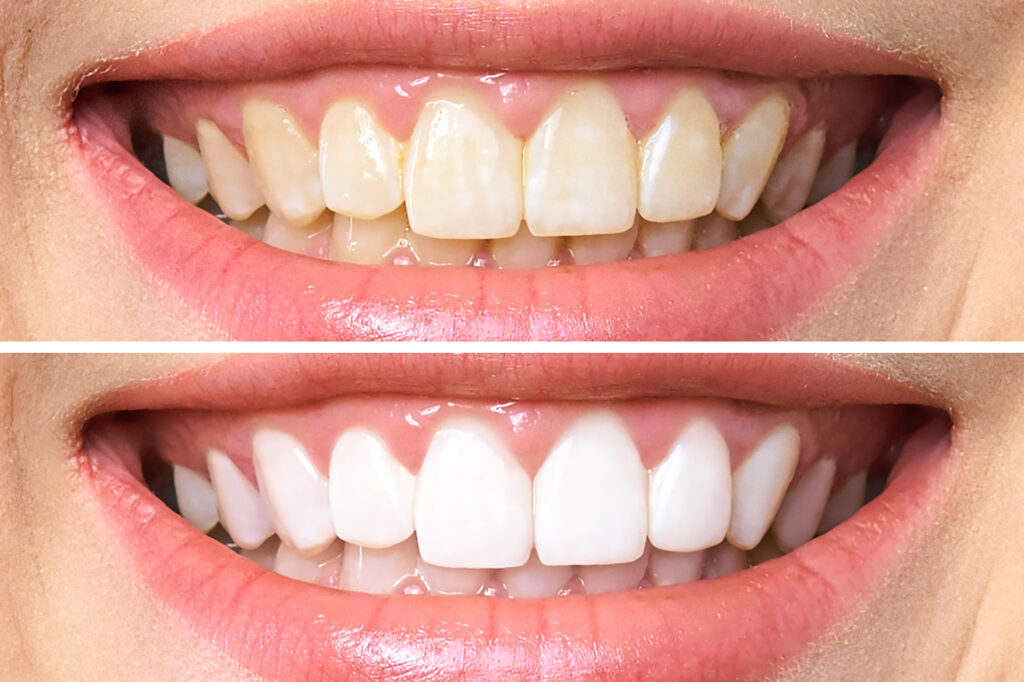 lema dental clinic