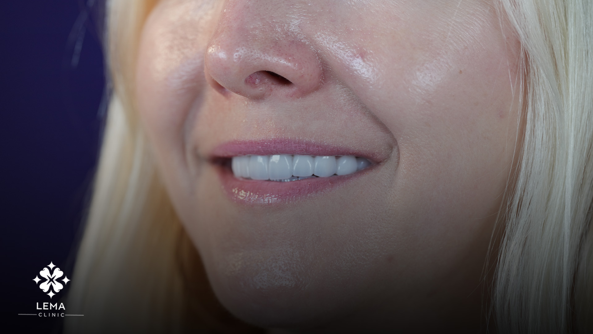 ursachen und behandlungen von diastema