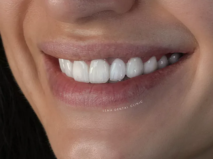 root canal treatment root canal treatment