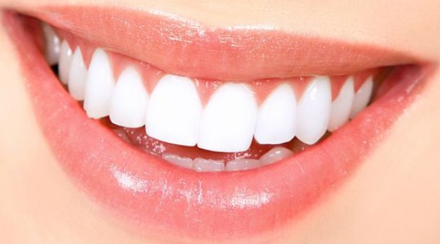 Steps To Achieve Perfect Teeth