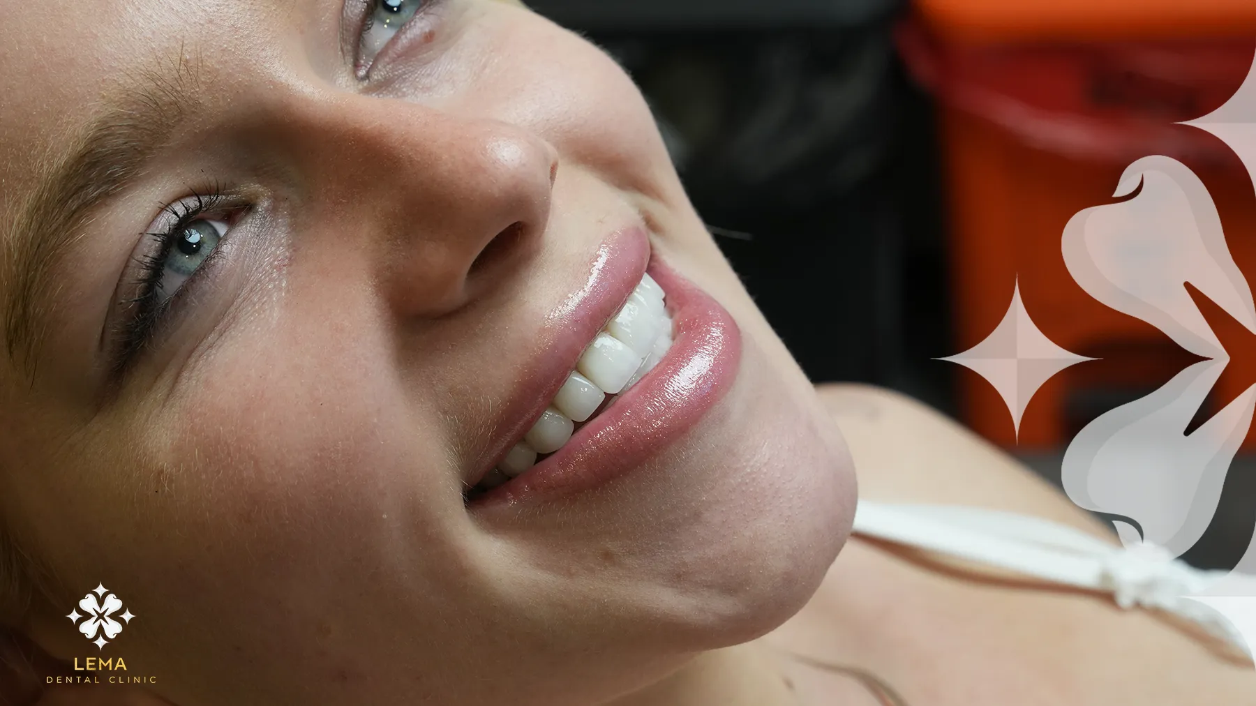 دليل الرعاية اللاحقة زرع الأسنان